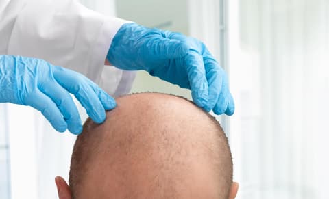 Trapianto di Capelli ad Istanbul